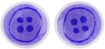 Gēla acu spilventiņi Makeup Revolution London Coraline Button Gel Eye Pads, 2 gab.